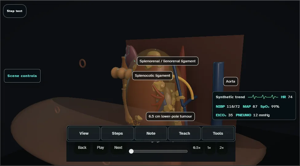 Radical nephrectomy (laparoscopic) - spatial danger atlas. Step 1: Imaging, side + position. Captured frame from the interactive animation.