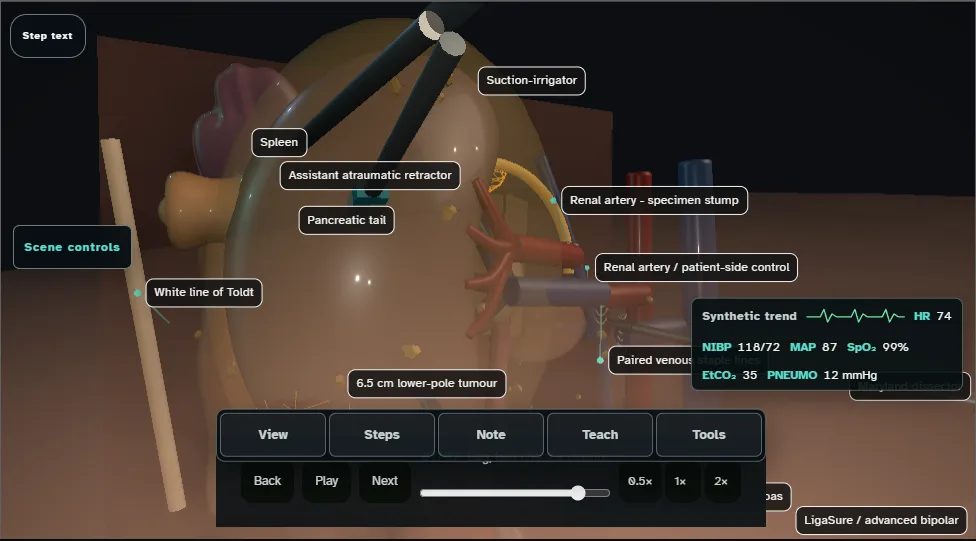 Radical nephrectomy (laparoscopic) - spatial danger atlas. Step 7: Bag, bed check + closure. Captured frame from the interactive animation.