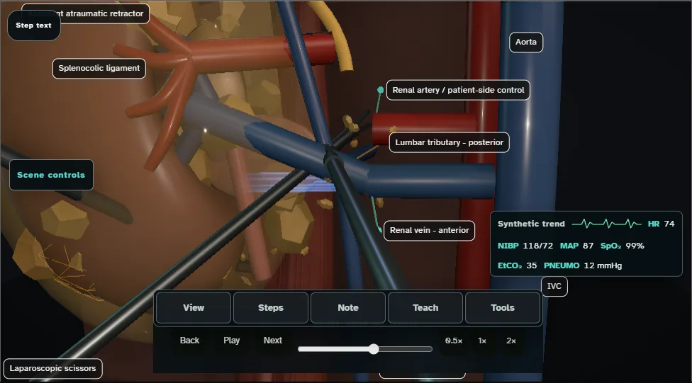 Radical nephrectomy (laparoscopic) - spatial danger atlas. Step 5: Renal vein control. Captured frame from the interactive animation.