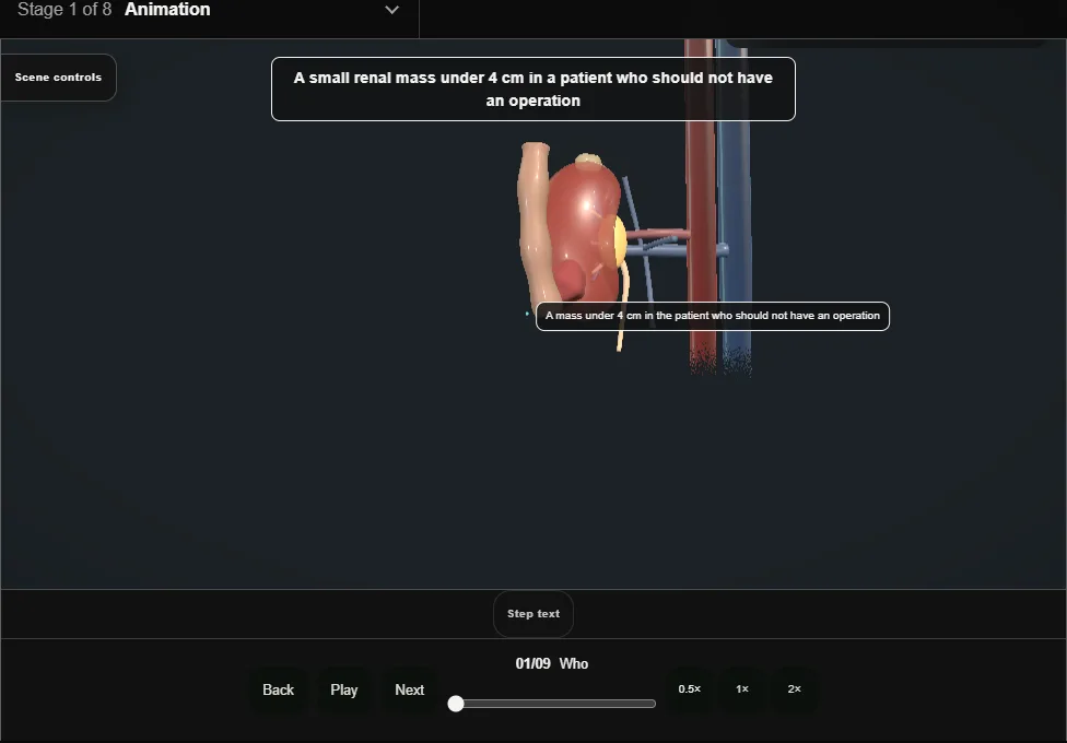 Renal tumour ablation. Step 1: Who. Captured frame from the interactive animation.