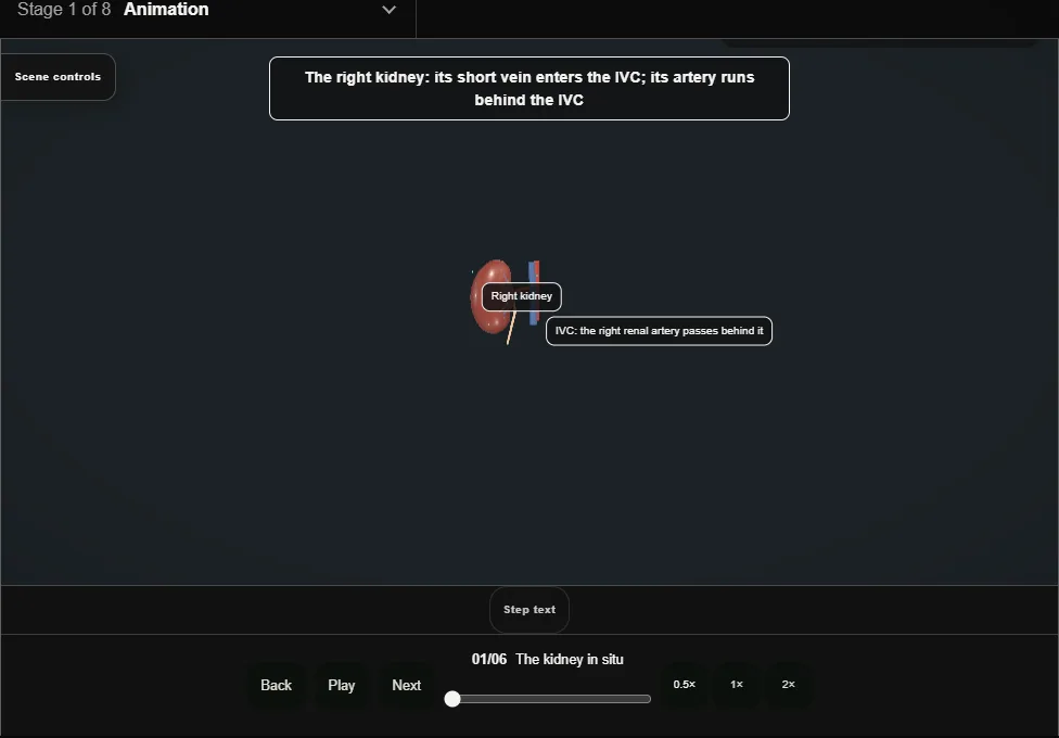 Blunt renal trauma: AAST grades. Step 1: The kidney in situ. Captured frame from the interactive animation.