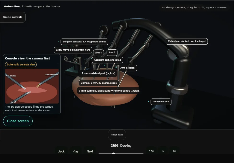Robotic surgery: the basics. Step 2: Docking. Captured frame from the interactive animation.