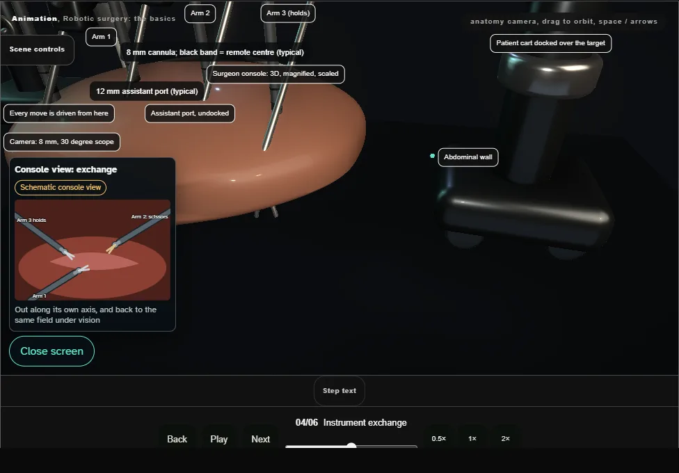 Robotic surgery: the basics. Step 4: Instrument exchange. Captured frame from the interactive animation.