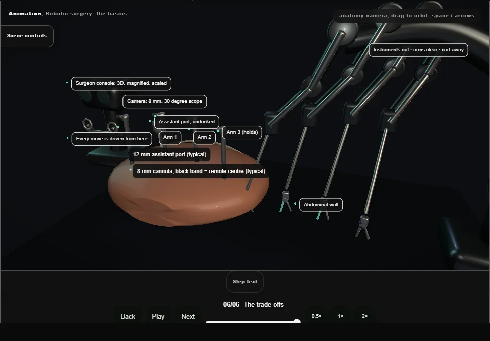 Robotic surgery: the basics. Step 6: The trade-offs. Captured frame from the interactive animation.