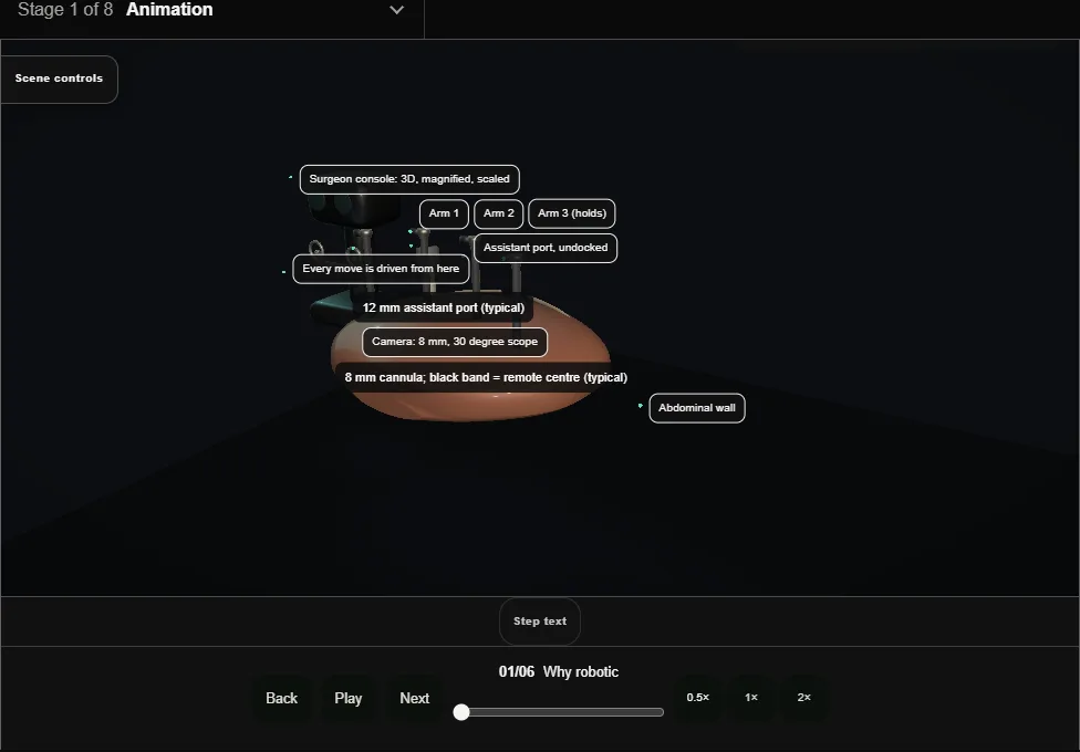 Robotic surgery: the basics. Step 1: Why robotic. Captured frame from the interactive animation.