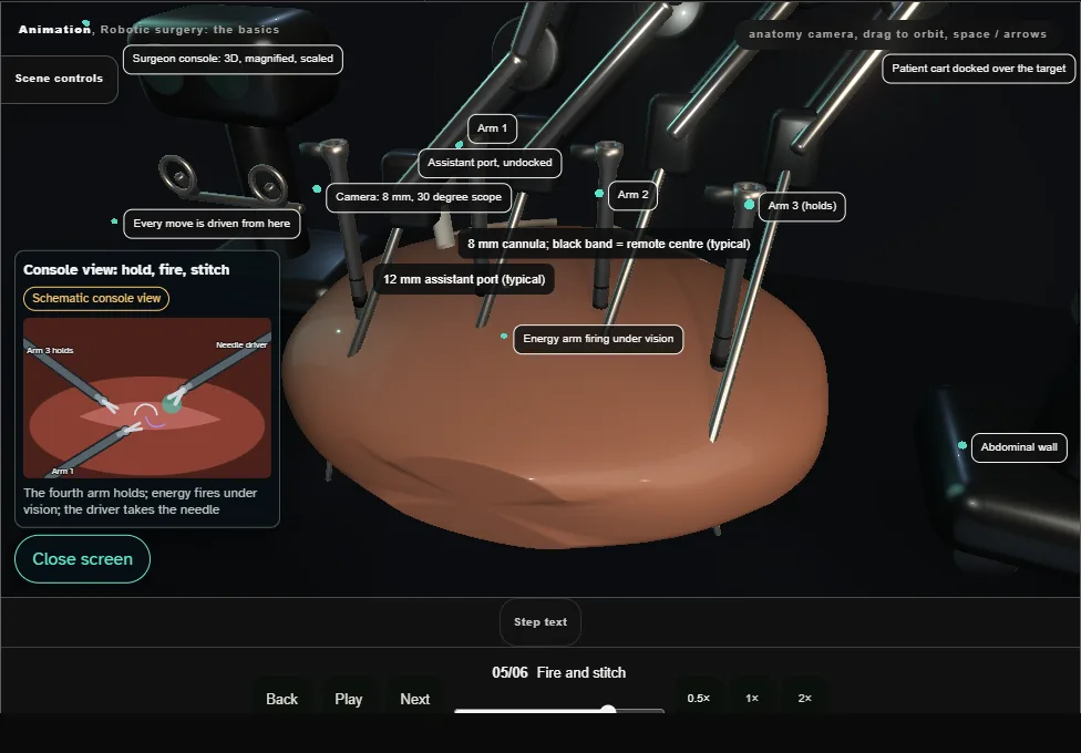 Robotic surgery: the basics. Step 5: Fire and stitch. Captured frame from the interactive animation.