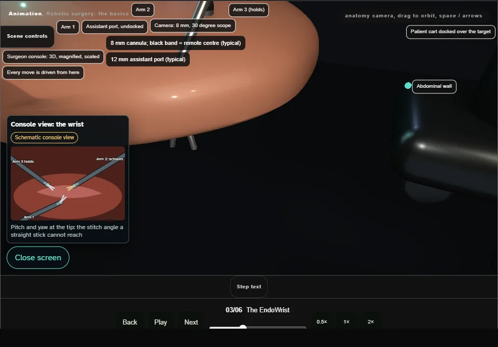 Robotic surgery: the basics. Step 3: The EndoWrist. Captured frame from the interactive animation.