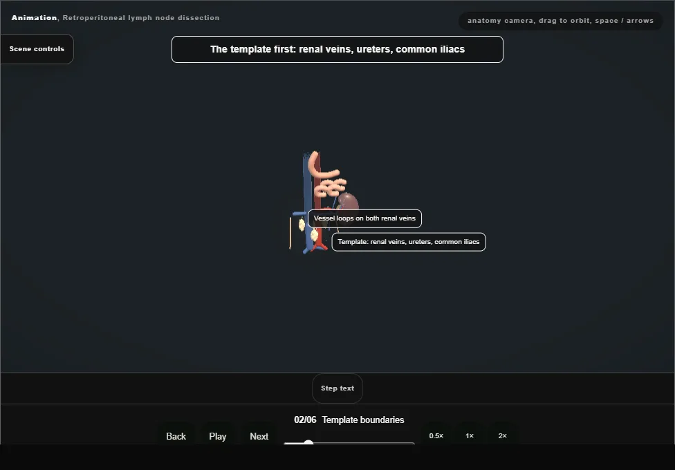 Retroperitoneal lymph node dissection. Step 2: Template boundaries. Captured frame from the interactive animation.