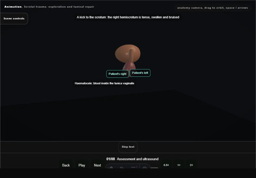 Scrotal trauma: exploration and tunical repair. Step 1: Assessment and ultrasound. Captured frame from the interactive animation.