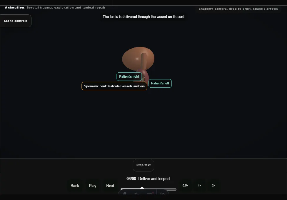 Scrotal trauma: exploration and tunical repair. Step 4: Deliver and inspect. Captured frame from the interactive animation.