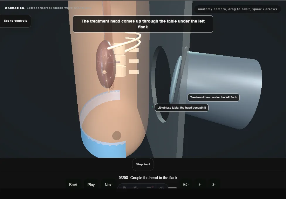 Extracorporeal shock wave lithotripsy. Step 3: Couple the head to the flank. Captured frame from the interactive animation.