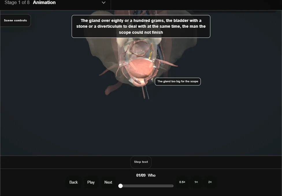 Simple prostatectomy (Millin retropubic). Step 1: Who. Captured frame from the interactive animation.