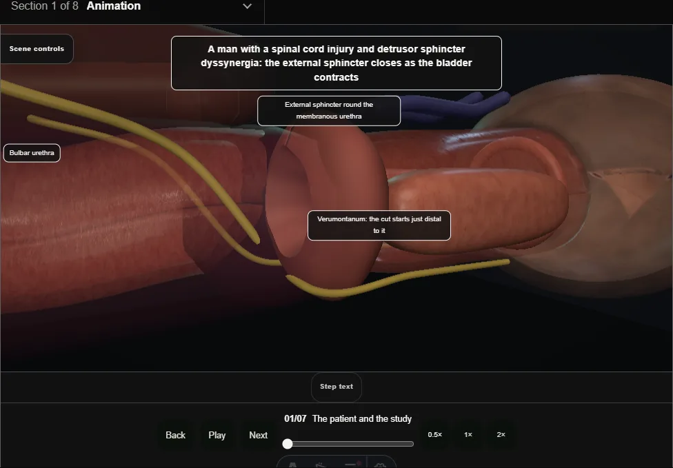 External sphincterotomy. Step 1: The patient and the study. Captured frame from the interactive animation.
