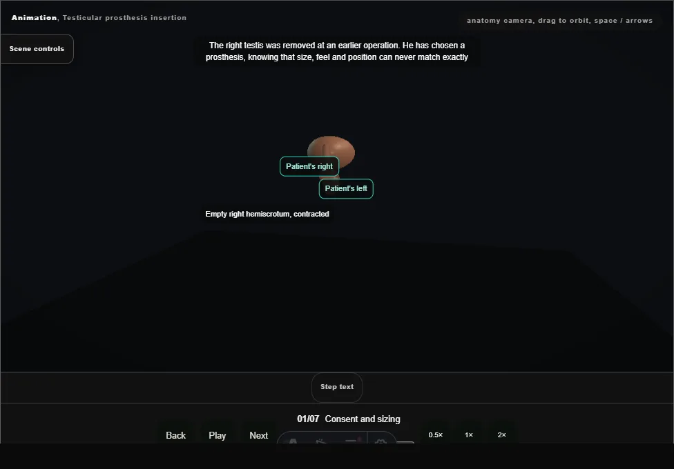 Testicular prosthesis insertion. Step 1: Consent and sizing. Captured frame from the interactive animation.