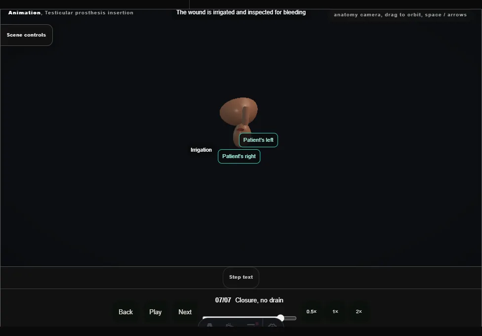 Testicular prosthesis insertion. Step 7: Closure, no drain. Captured frame from the interactive animation.