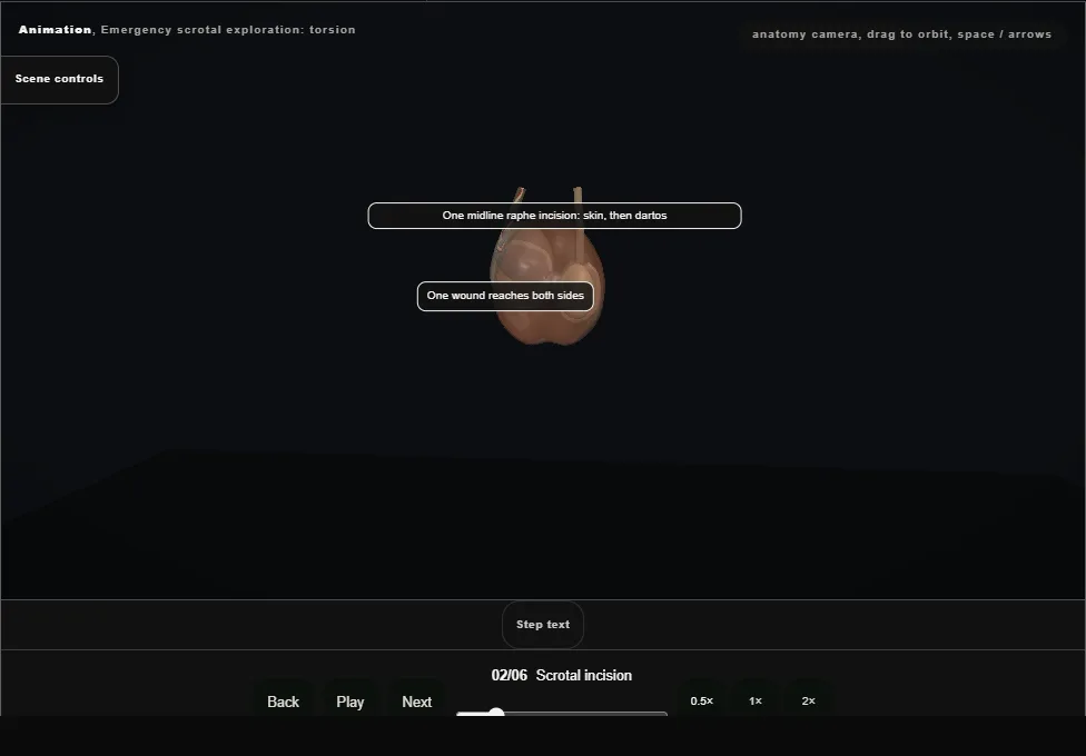 Emergency scrotal exploration: torsion. Step 2: Scrotal incision. Captured frame from the interactive animation.
