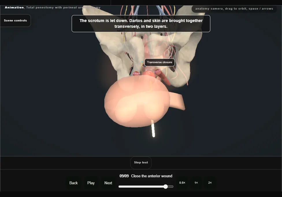 Total penectomy with perineal urethrostomy. Step 9: Close the anterior wound. Captured frame from the interactive animation.