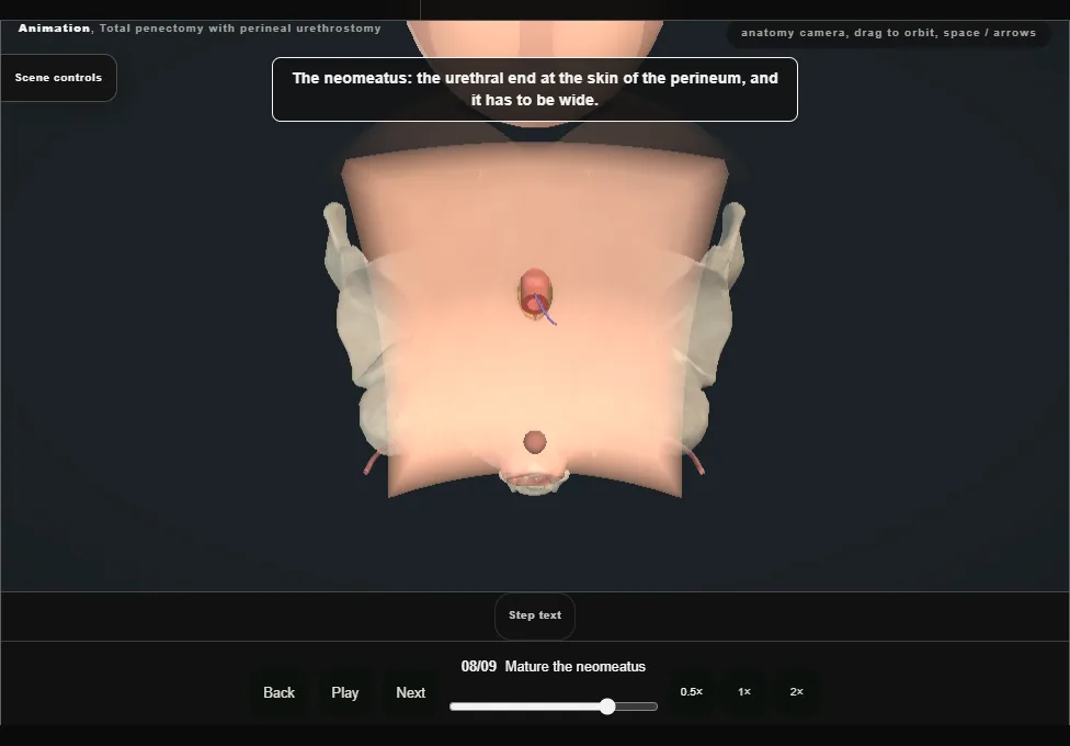 Total penectomy with perineal urethrostomy. Step 8: Mature the neomeatus. Captured frame from the interactive animation.