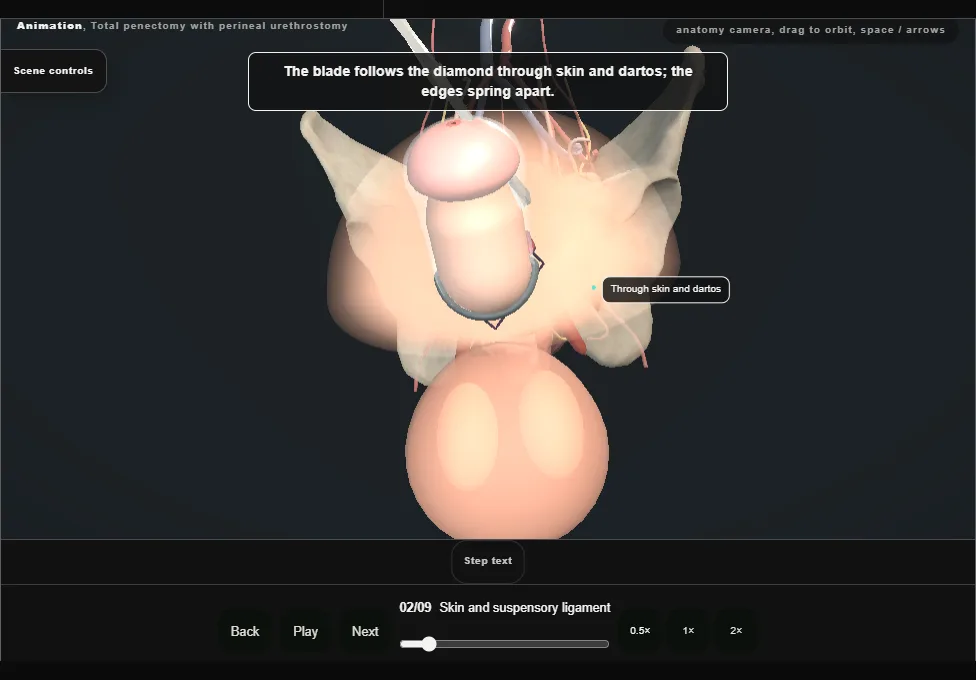 Total penectomy with perineal urethrostomy. Step 2: Skin and suspensory ligament. Captured frame from the interactive animation.