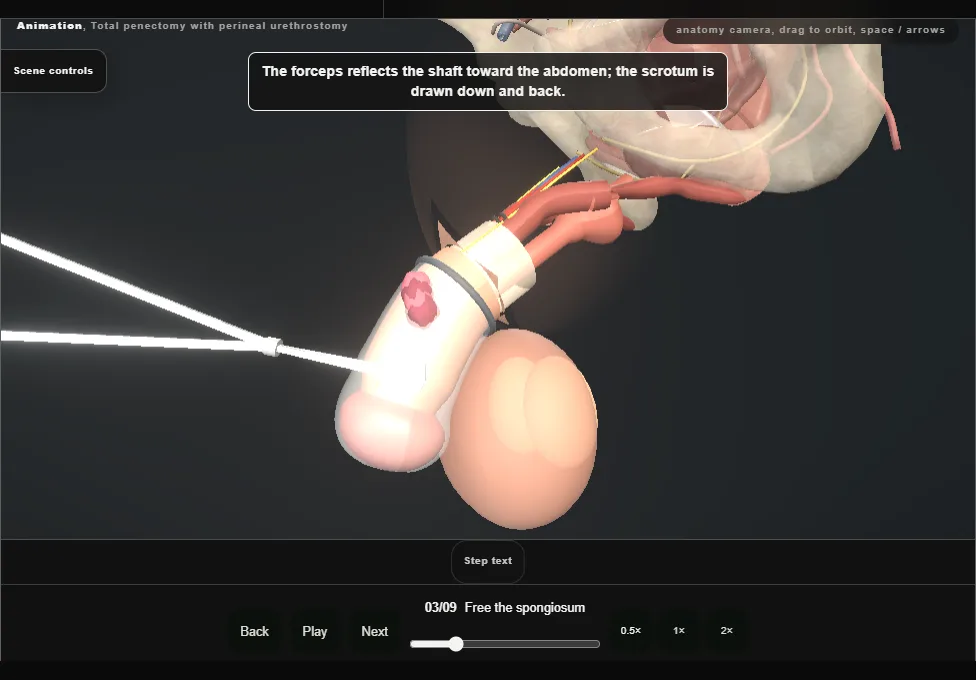 Total penectomy with perineal urethrostomy. Step 3: Free the spongiosum. Captured frame from the interactive animation.
