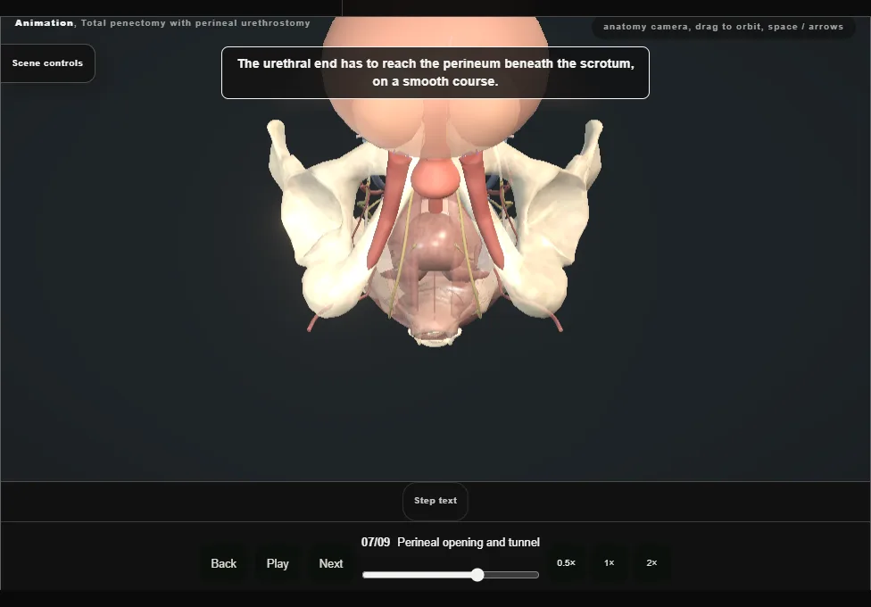 Total penectomy with perineal urethrostomy. Step 7: Perineal opening and tunnel. Captured frame from the interactive animation.