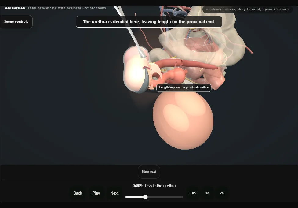 Total penectomy with perineal urethrostomy. Step 4: Divide the urethra. Captured frame from the interactive animation.
