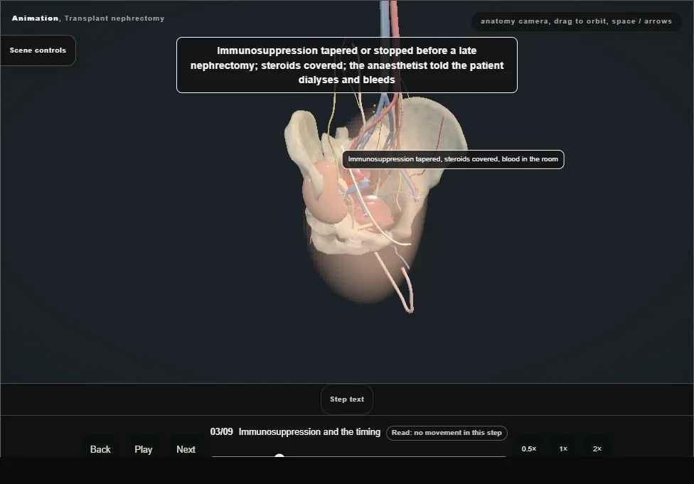 Transplant nephrectomy. Step 3: Immunosuppression and the timing. Captured frame from the interactive animation.