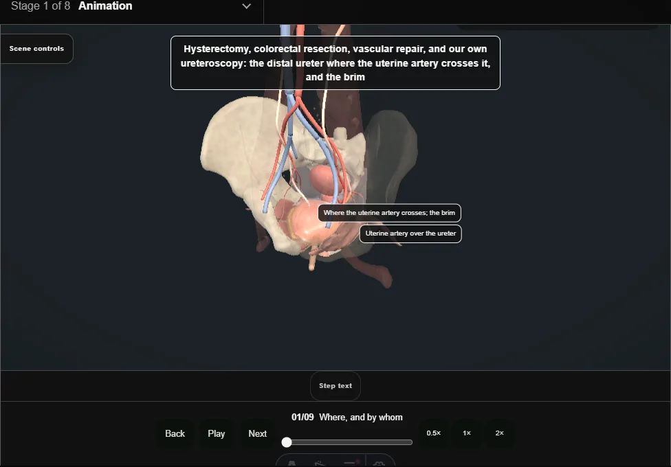 Ureteric injury: recognition and repair. Step 1: Where, and by whom. Captured frame from the interactive animation.