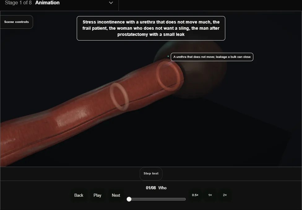 Urethral bulking injection. Step 1: Who. Captured frame from the interactive animation.