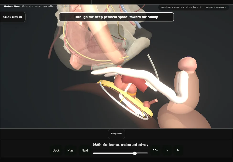 Male urethrectomy after cystectomy. Step 8: Membranous urethra and delivery. Captured frame from the interactive animation.