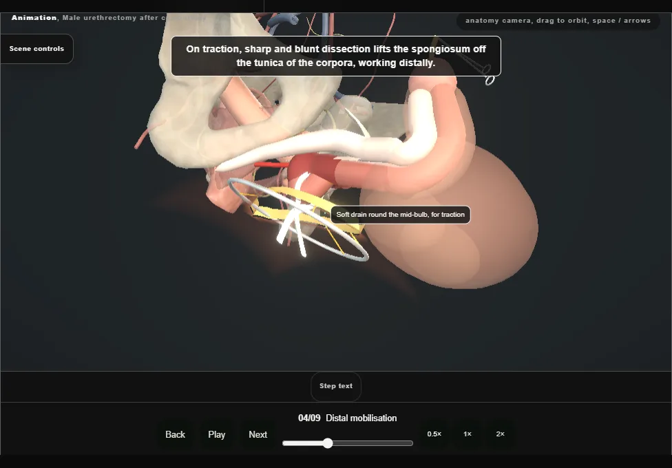 Male urethrectomy after cystectomy. Step 4: Distal mobilisation. Captured frame from the interactive animation.