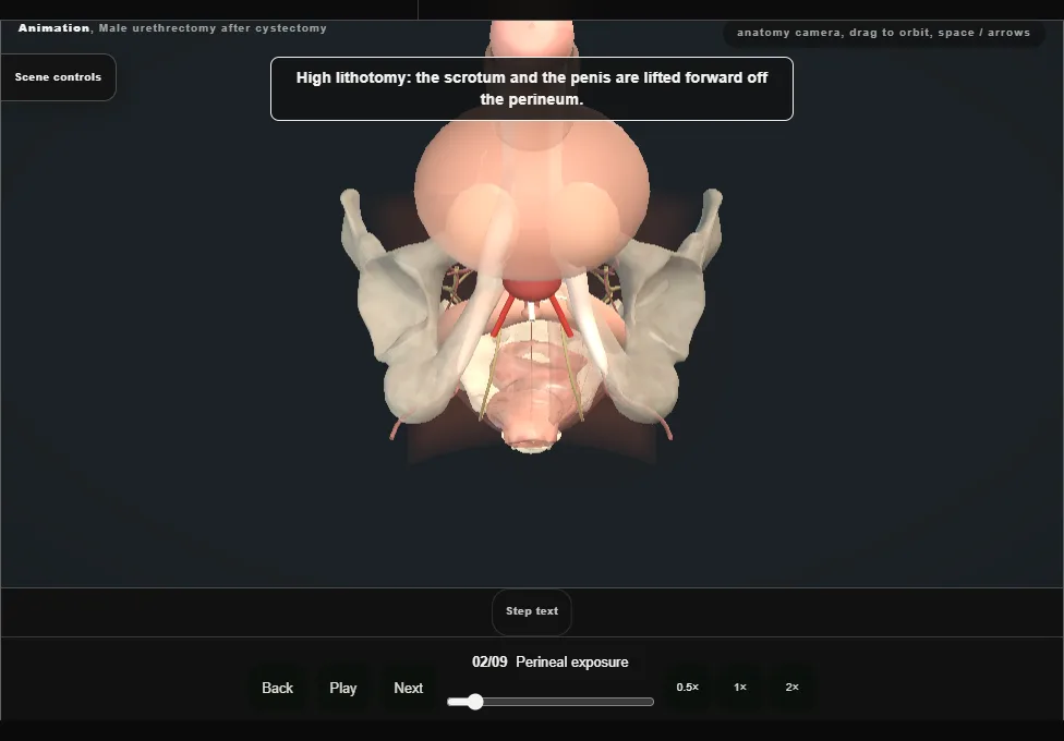 Male urethrectomy after cystectomy. Step 2: Perineal exposure. Captured frame from the interactive animation.