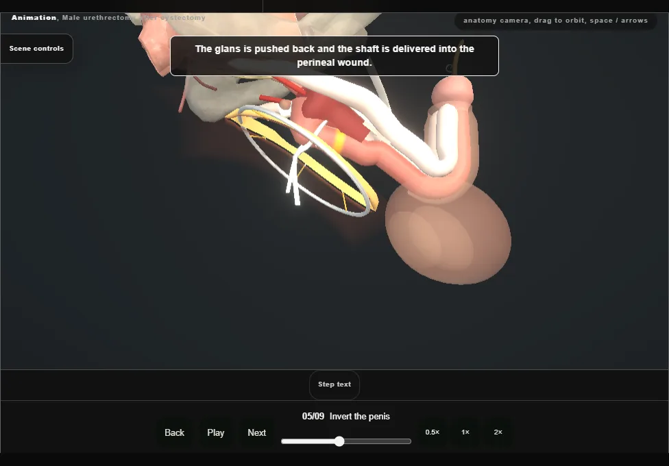 Male urethrectomy after cystectomy. Step 5: Invert the penis. Captured frame from the interactive animation.