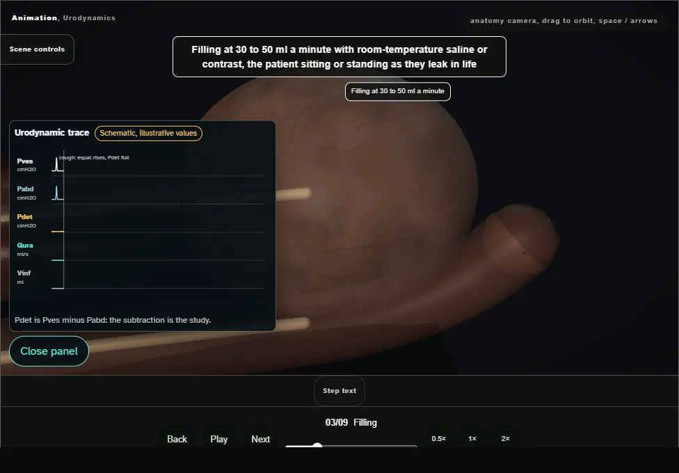 Urodynamics. Step 3: Filling. Captured frame from the interactive animation.