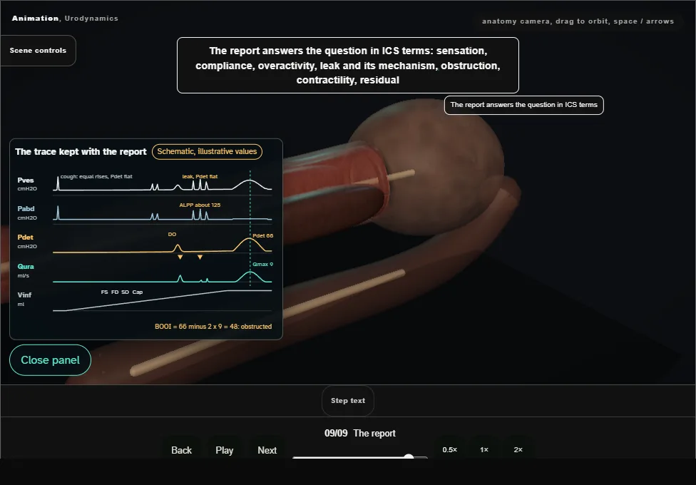 Urodynamics. Step 9: The report. Captured frame from the interactive animation.