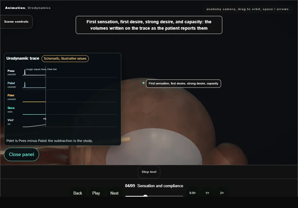 Urodynamics. Step 4: Sensation and compliance. Captured frame from the interactive animation.