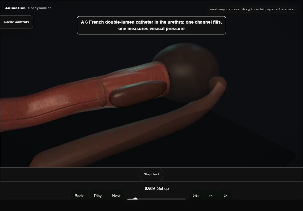 Urodynamics. Step 2: Set up. Captured frame from the interactive animation.