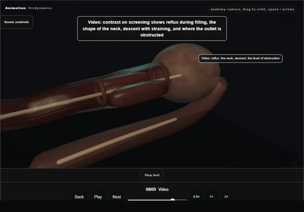 Urodynamics. Step 8: Video. Captured frame from the interactive animation.