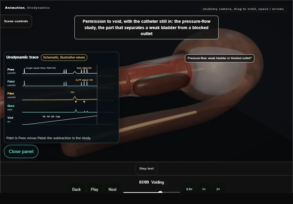 Urodynamics. Step 7: Voiding. Captured frame from the interactive animation.