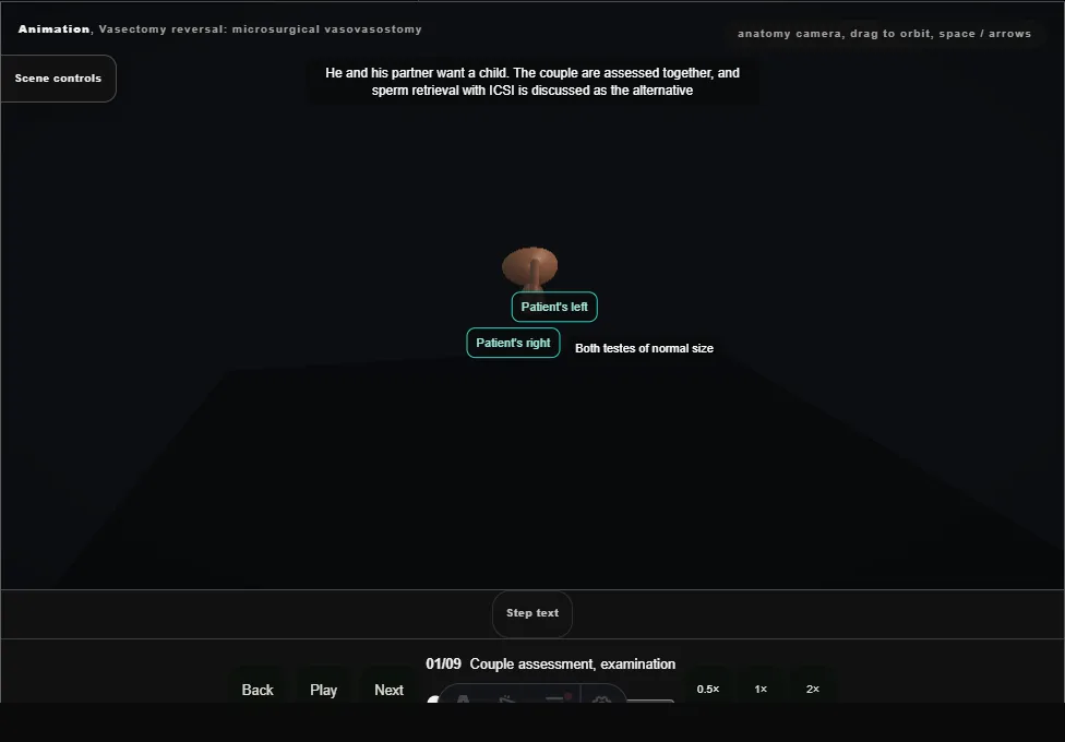 Vasectomy reversal: microsurgical vasovasostomy. Step 1: Couple assessment, examination. Captured frame from the interactive animation.
